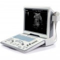 ALAT USG Mindray DP-50 Alat USG DP50